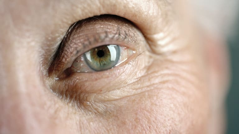 Fehlender Lidschlussreflex weist auf baldigen Tod
