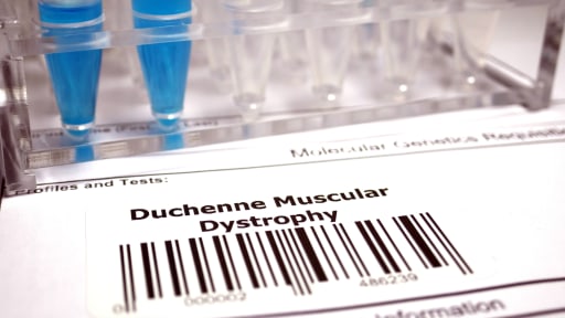 Duchenne-Muskeldystrophie