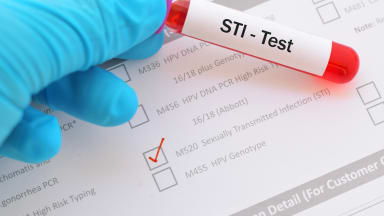 5 häufige STIs: Erkennen, therapieren, aufklären