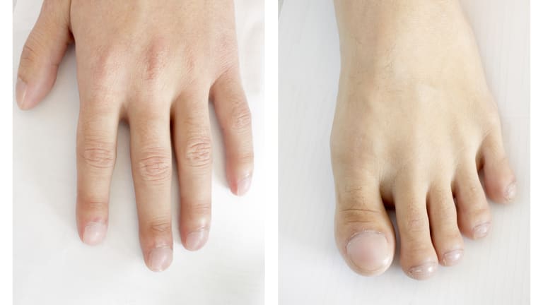 Trommelschlägelfinger und Uhrglasnägel