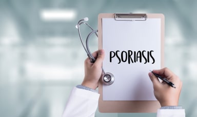 S3-Leitlinie Therapie der Psoriasis vulgaris