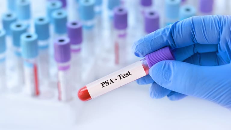 Prostatakrebs-Screening wahrscheinlich ähnlich effektiv wie Brustkrebs-Screening
