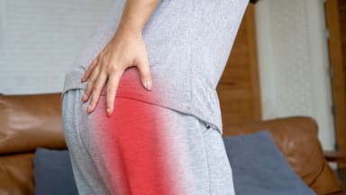 Piriformis-Syndrom: Wenn Ischialgie nicht spinal bedingt ist