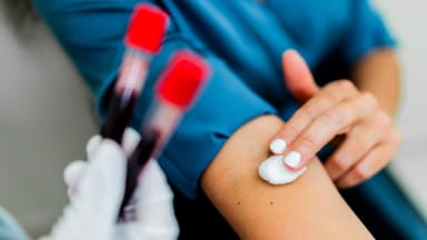 5 häufig bestimmte Laborwerte, bei denen Hausärzte genauer hinschauen sollten