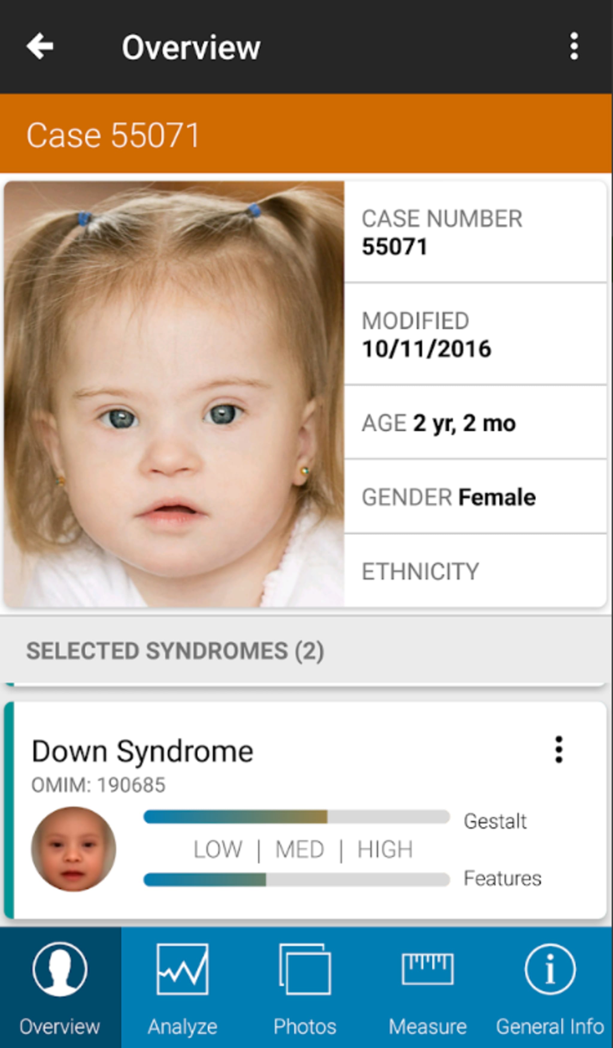Face2Gene benötigt zunächst ein Foto und weitere Informationen des Patienten. Per künstlicher Intellegenz erkennt die App am Gesicht eine möglicherweise vorliegende Erbkrankheit. 