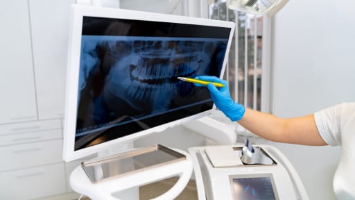 Röntgenbild Zahnbehandlung