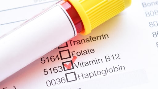Vitamin B12: Aktualisierte Diagnostik