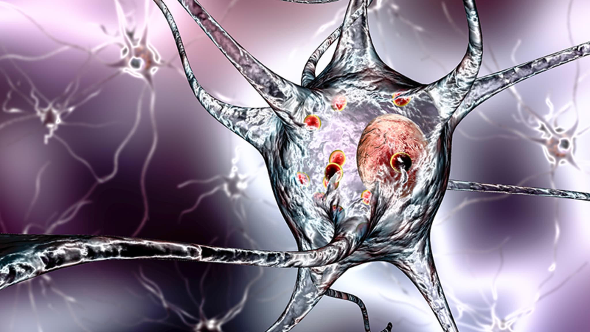 Parkinson Update zu Diagnostik und Therapie