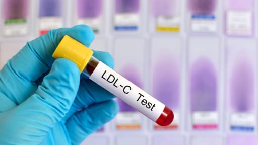 Symbolbild eines LDL-C-Tests
