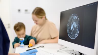 Schädel-MRT eines Kindes