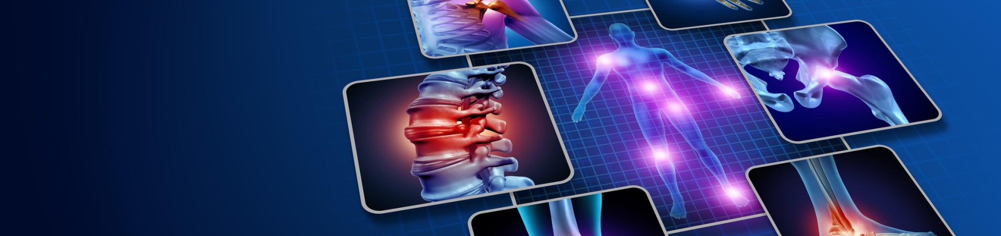 Rheumatologie