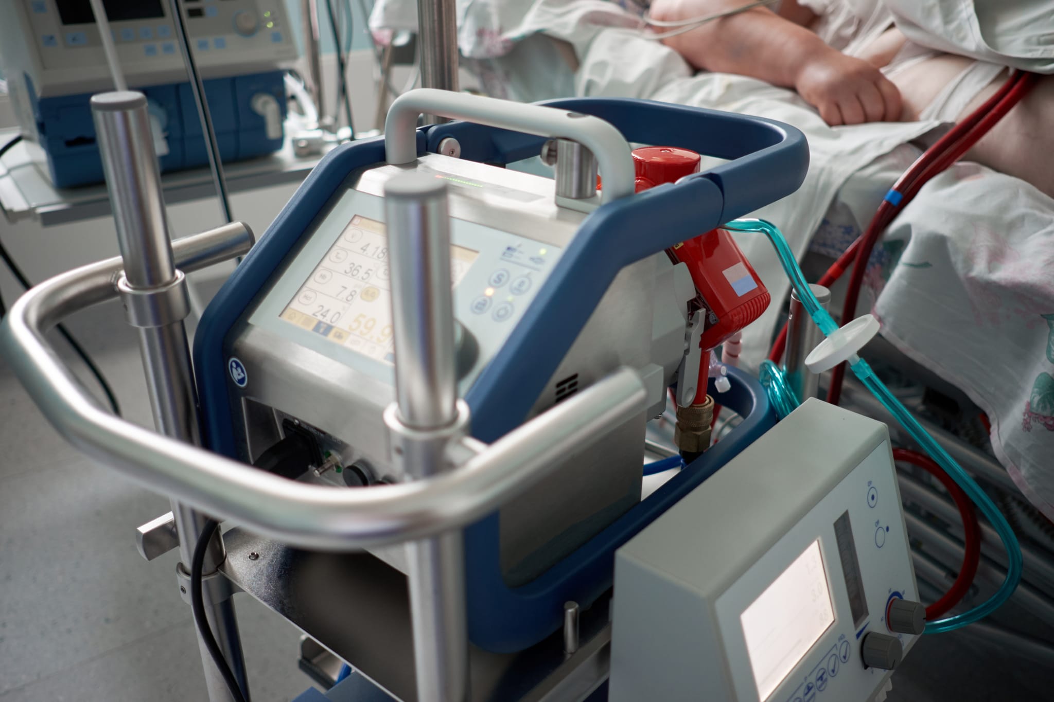ECMO-Therapie in der Pandemie: Experten alarmiert wegen Sterberaten - coliquio