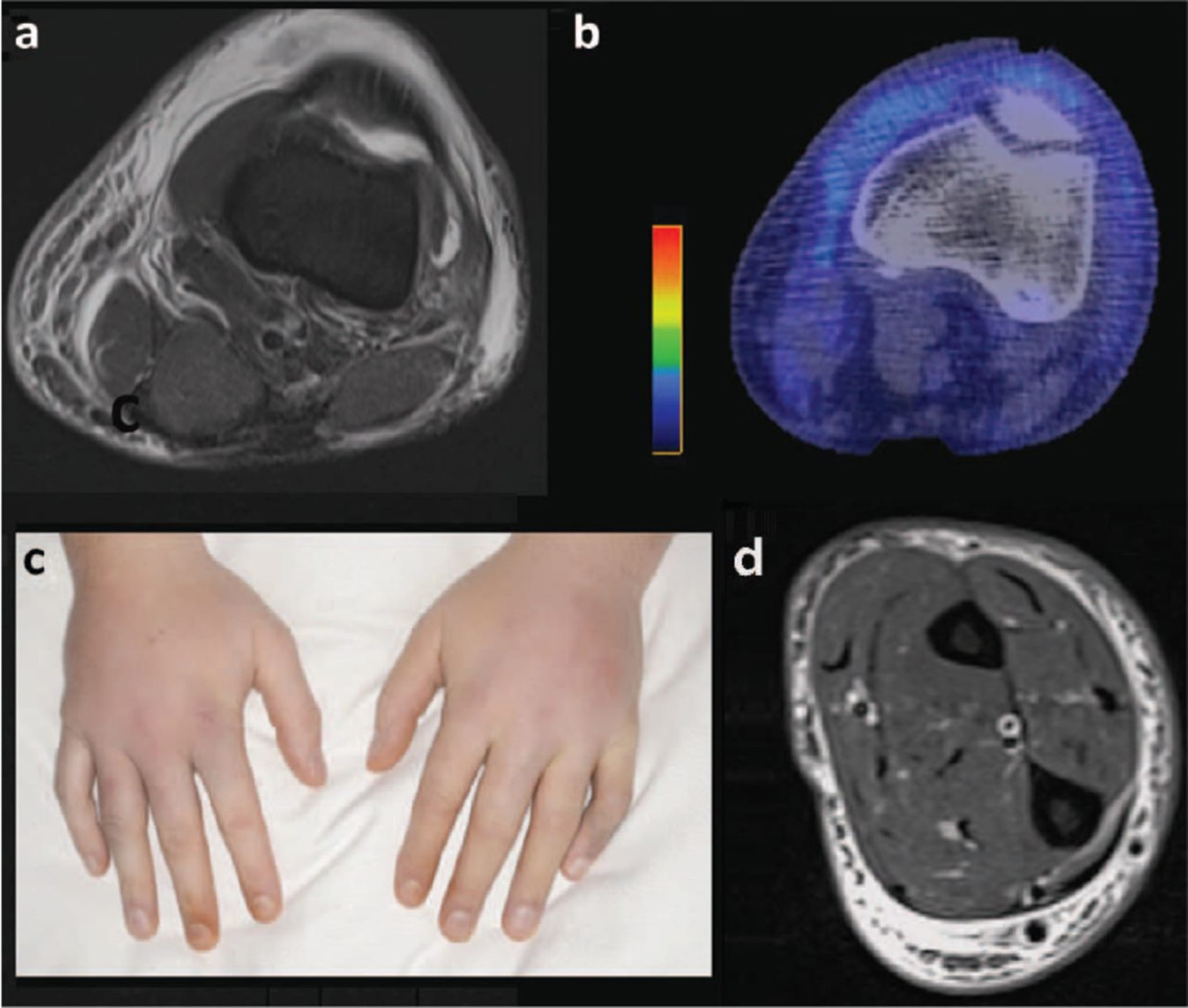Schwellungen am ganzen Körper - coliquio
