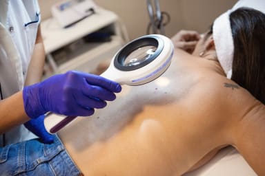 Hautkrebsscreening soll zu den ersten Leistungskürzungen für GKV-Versicherte zählen