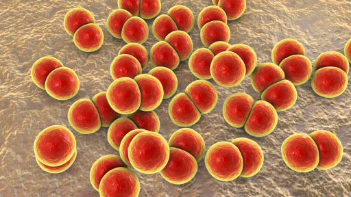 Schwere Hornhaut-Komplikation durch Gonokokken-Infektion
