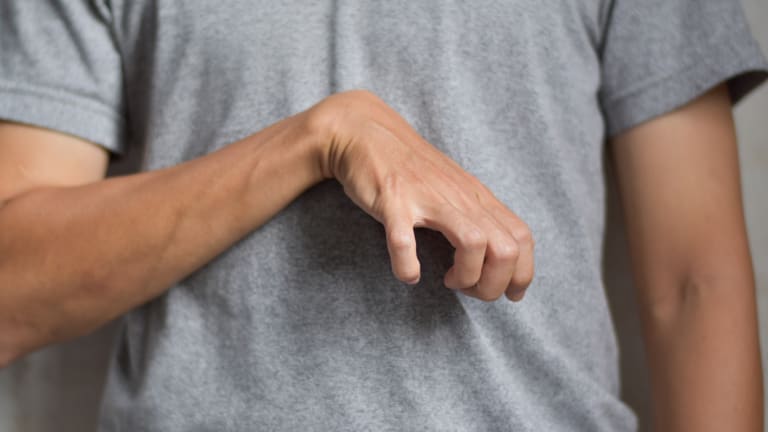 spastic hand