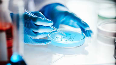 Neue Haut aus Mini-Biopsie – Durchbruch bei Verbrennungen?