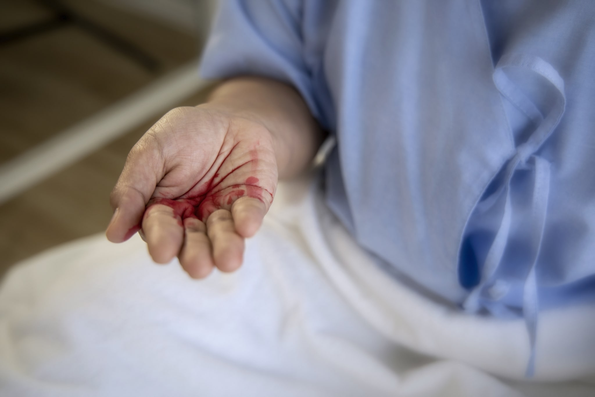 Blut beim Husten: Was ist zu tun?