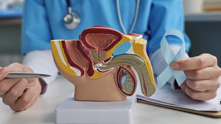 Prostatakarzinom: Oxybutynin hilft bei ADT-induzierten Hitzewallungen