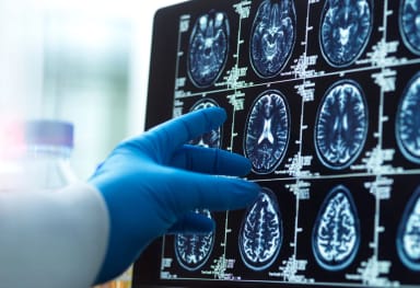 brain ct 