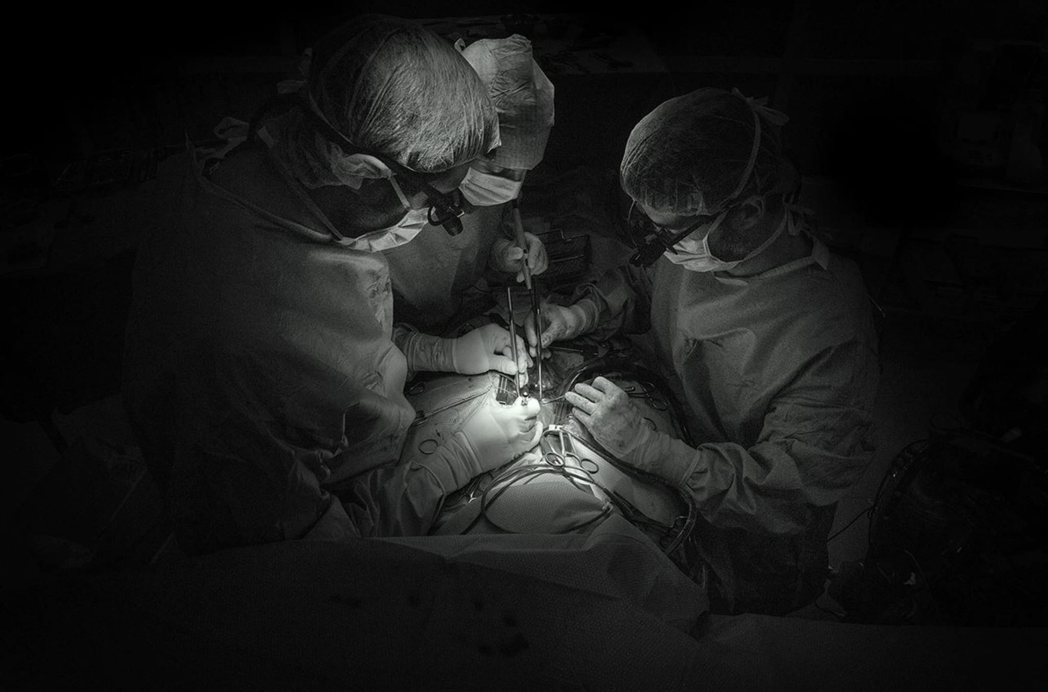 Nähen eines Koronargefäßes während einer Bypass-Operation.