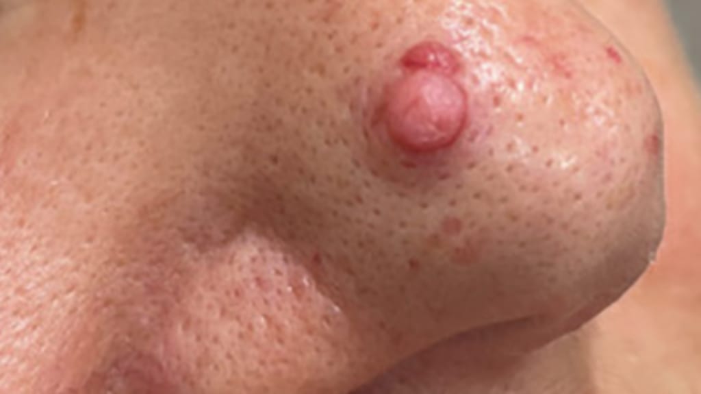 Gestielte pinke Papel auf der Nase