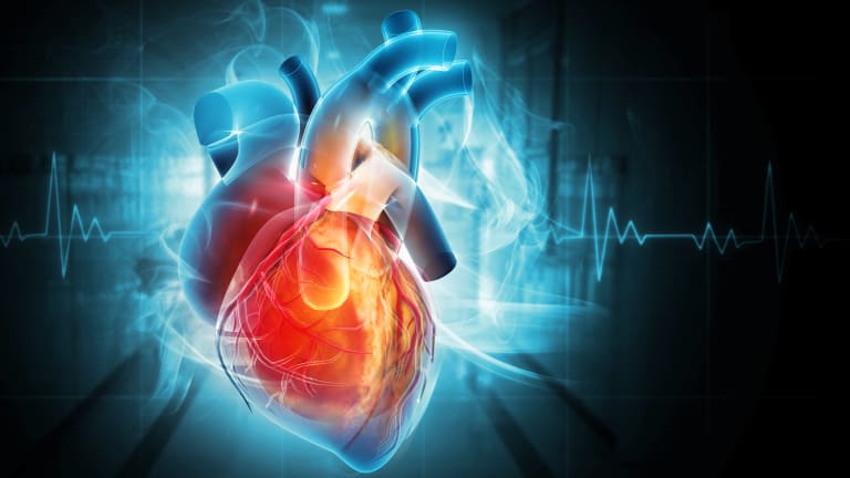 CT-Angiographie in der Diagnostik der koronaren Herzerkrankung