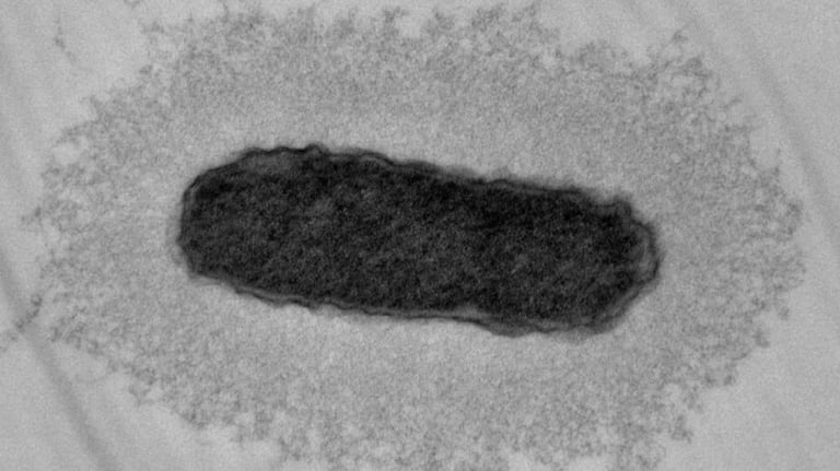 klebsiella.png