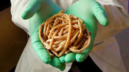 Helminthosen und ihre Symptome