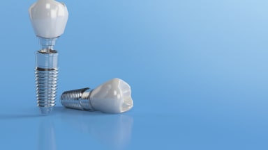 S3-Leitlinie zur Implantatversorgung unter Antiresorptiva aktualisiert