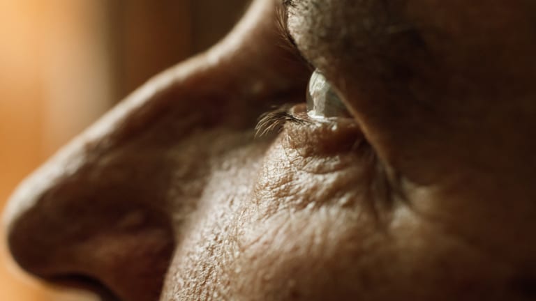  Levodopa kann die Progression zur neovaskulären AMD hemmen