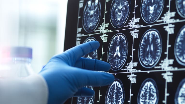 KI in der Medizin: Wo ist sie Ärzten überlegen?