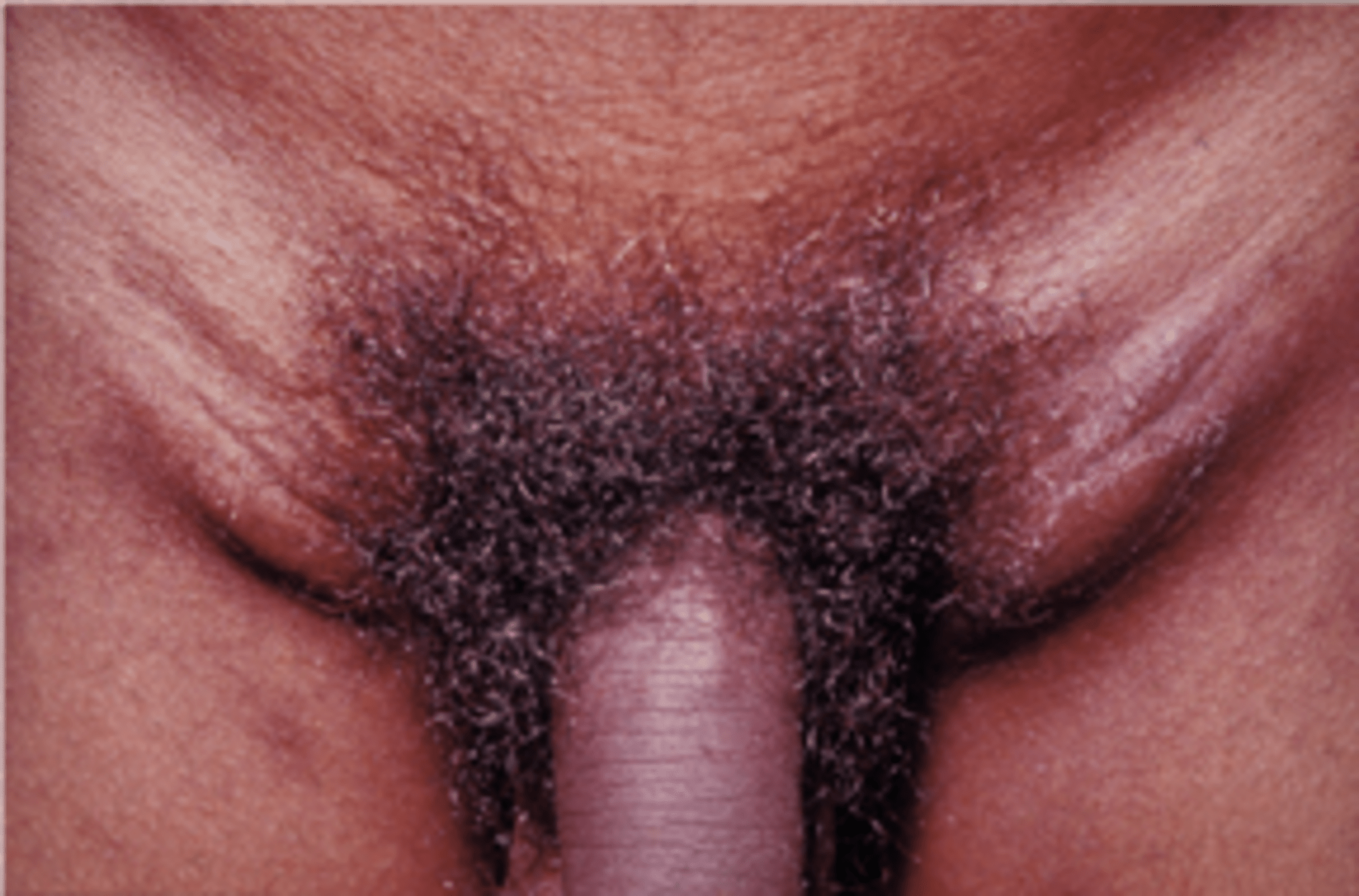 Oriq va kichik qizlar bilan porno Xotin jinsiy xotini bilan eri filmlar