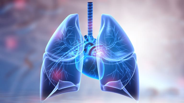 Hoher PEEP ohne Nutzen bei Bauchoperationen