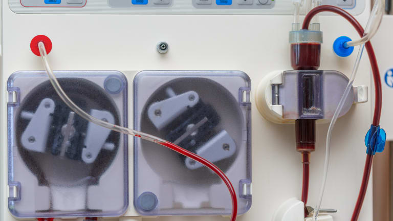 Bessere Überlebenschancen mit Peritonealdialyse statt Hämodialyse?