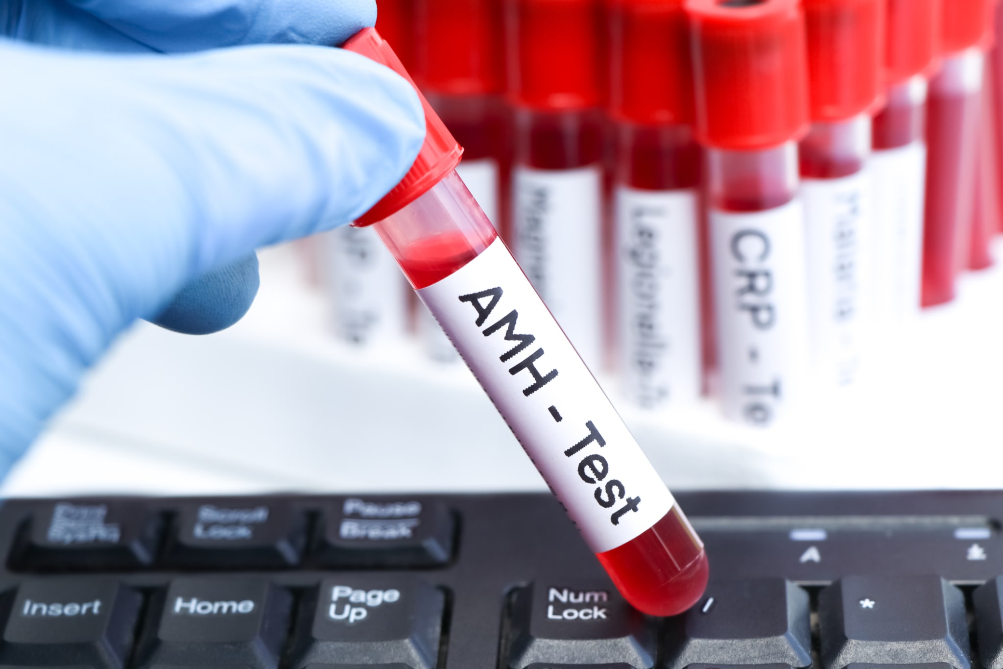 Anti-Müller-Hormon und Progesteron keine Fertilitätsmarker