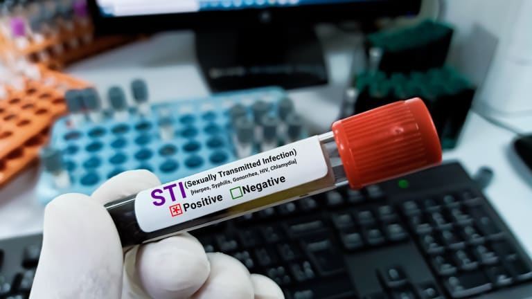 STI-Prävention: Leitlinien zu Doxycyclin als Postexpositionsprophylaxe veröffentlicht