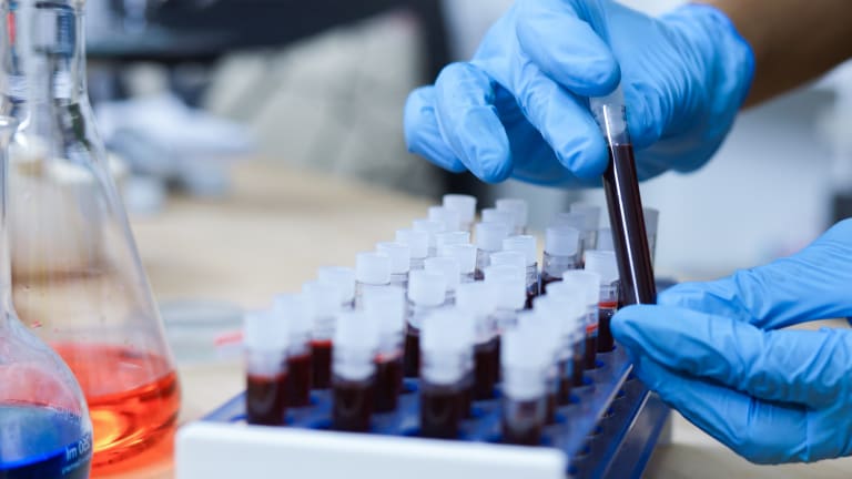 Hände in blauen Handschuhen, die ein Röhrchen mit Blut halten