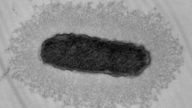 klebsiella.png