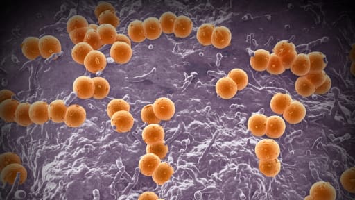  Warum eine Behandlung bei Meningokokken schnell gehen muss