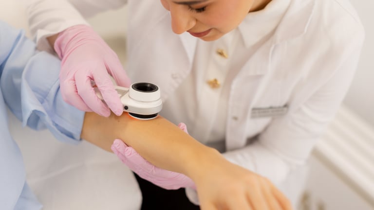 Dermatoskop