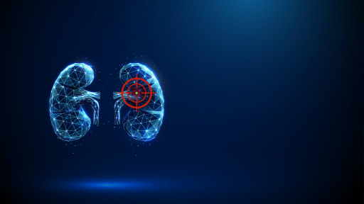 Chronische Nierenerkrankung: Dieser Diagnosefehler kann Leben kosten