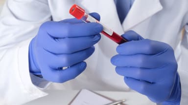 Blut in einem Röhrchen