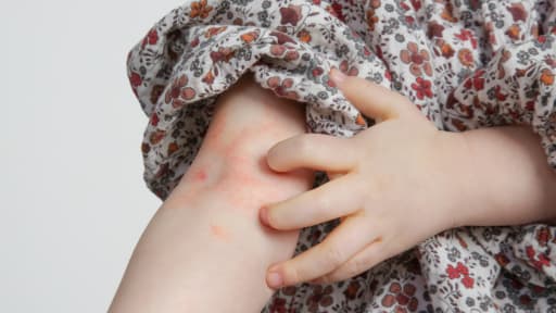 AD bei Kindern: Einige haben geringere Chance auf Remission