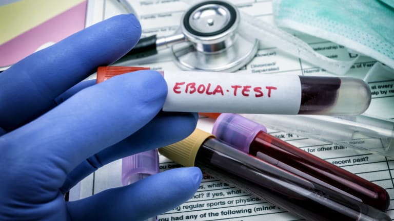 Ebola im Kongo: Wie gefährlich ist der Ausbruch?