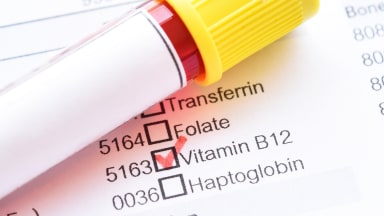 Vitamin B12: Aktualisierte Diagnostik