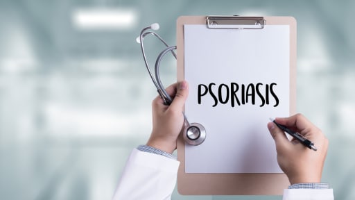 S3-Leitlinie Therapie der Psoriasis vulgaris
