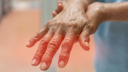 S1-Leitlinie Diagnostik bei Polyneuropathien