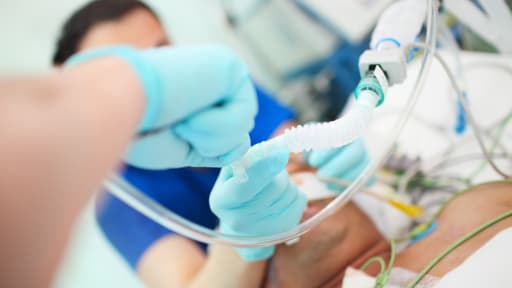 Patient wird intubiert