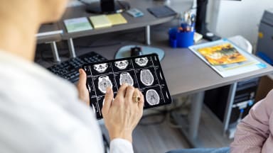 mrt brain creutzfeldt-jakob-disease